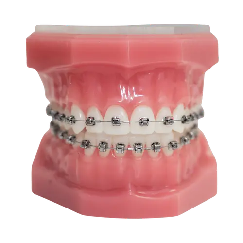 Orthodontic Course for General Practitioner